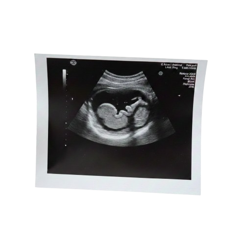 Иллюстрация планирования беременности